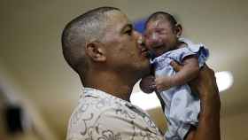 La microcefalia y su relación con el virus zika, una causa de preocupación en las embarazadas