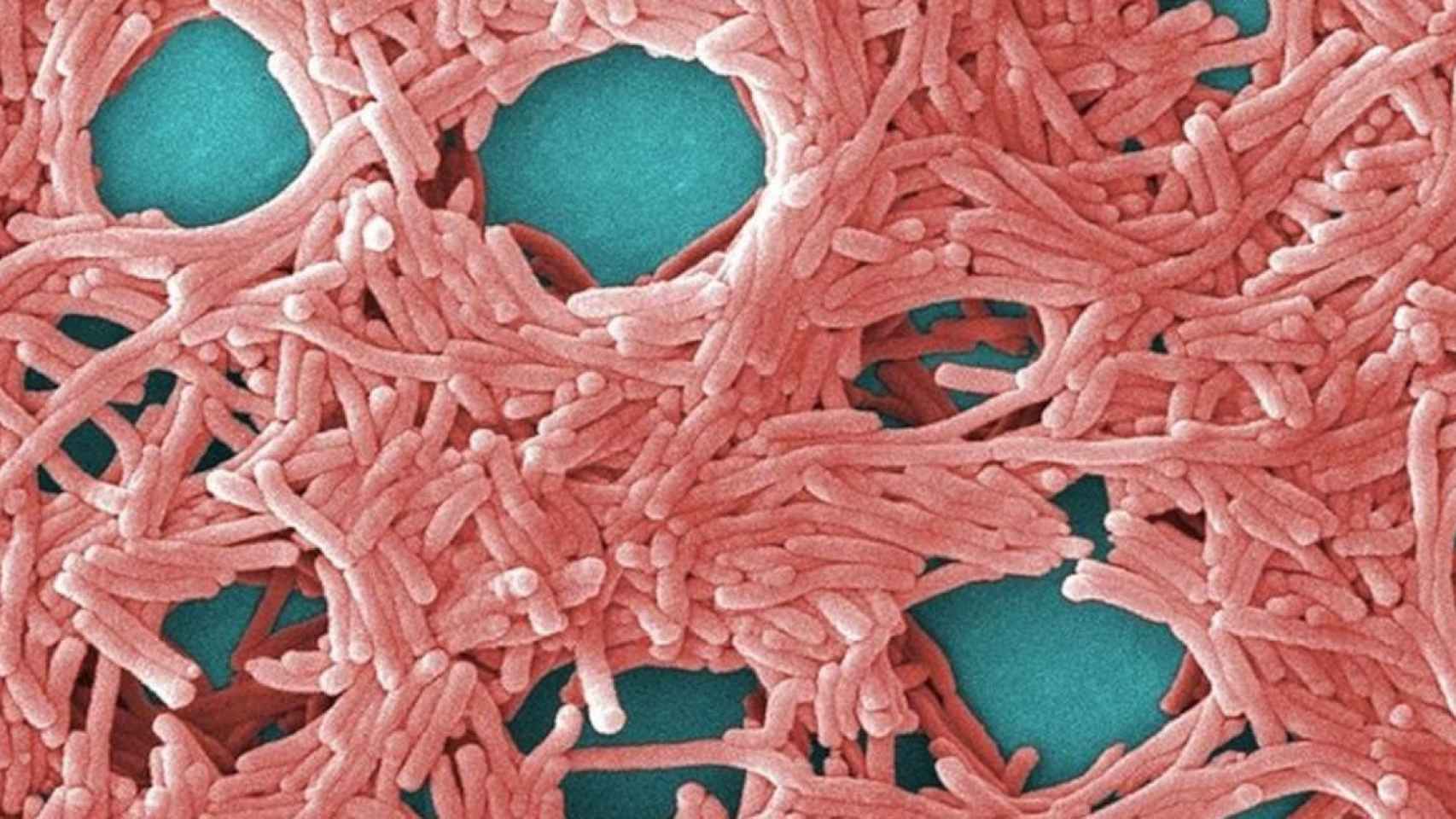 Bacterias de legionela, causante de las infecciones de legionelosis, en una imagen microscópica / EP