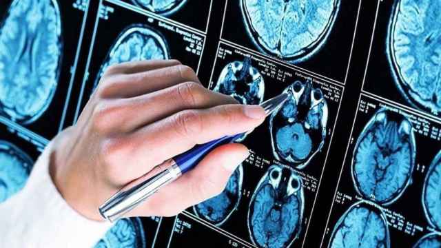 Pruebas de la afectación cerebral de demencia y alzhéimer / EP