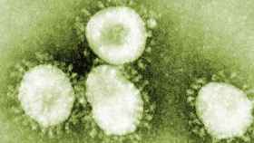 El coronavirus visto en el microscopio / SALUT