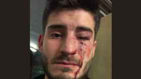 Una imagen de la víctima de una agresión homófoba en el Metro de Barcelona / TWITTER