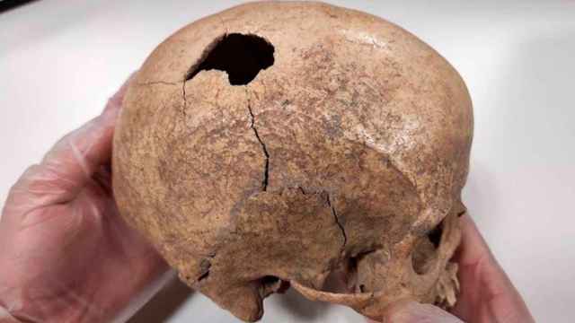 La fractura en el cráneo que causó la muerte del hombre hace 5.000 años / IPHES