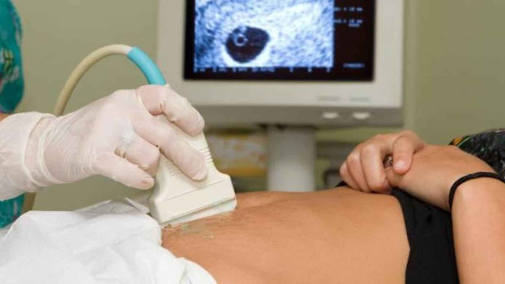 Un profesional realiza una ecografía a una mujer embarazada / EP