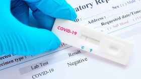 Test de detección rápida del coronavirus / DIPUTACIÓN DE BARCELONA