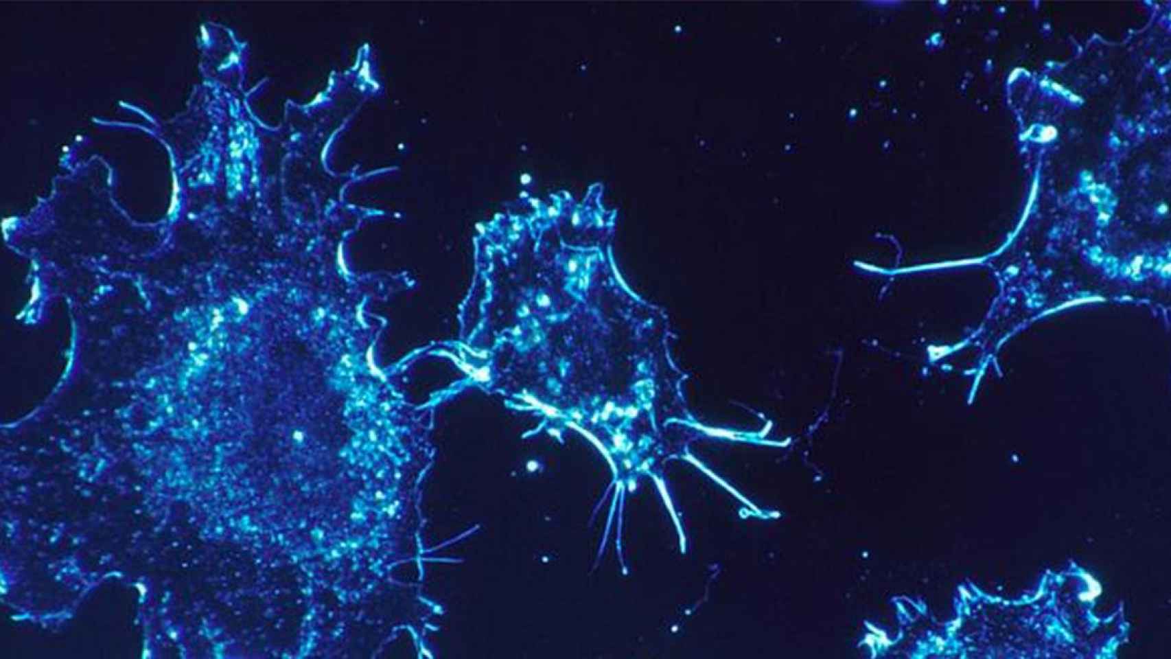 Células cancerosas, responsables de la formación de tumores / CG