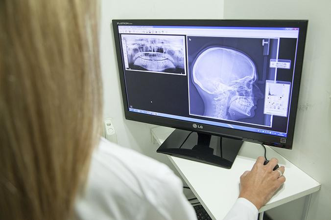 Doctora examinando una radiografía de cráneo / PIXABAY
