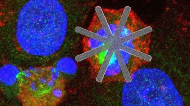 Célula HeLa con un nanochip de silicio en su interior que permite estudiar los procesos de división celular. UOC / EP