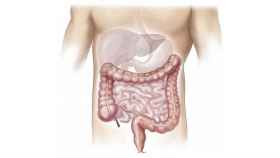 Intestinos, lugar al que afecta la enfermedad de Crohn / PIXABAY