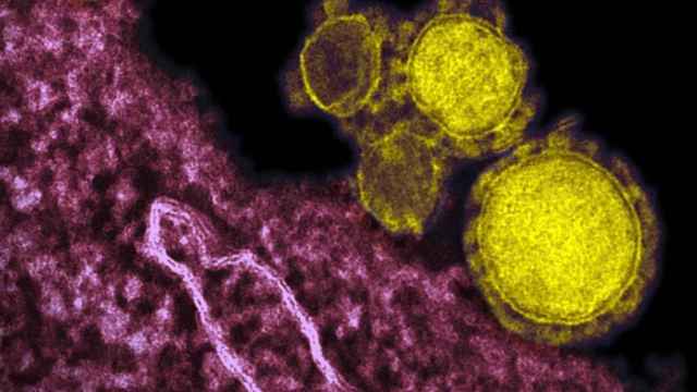 Imagen microscópica del coronavirus / EP