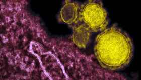 Imagen microscópica del coronavirus / EP