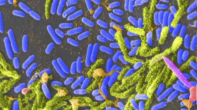 Bacterias del cólera / EP