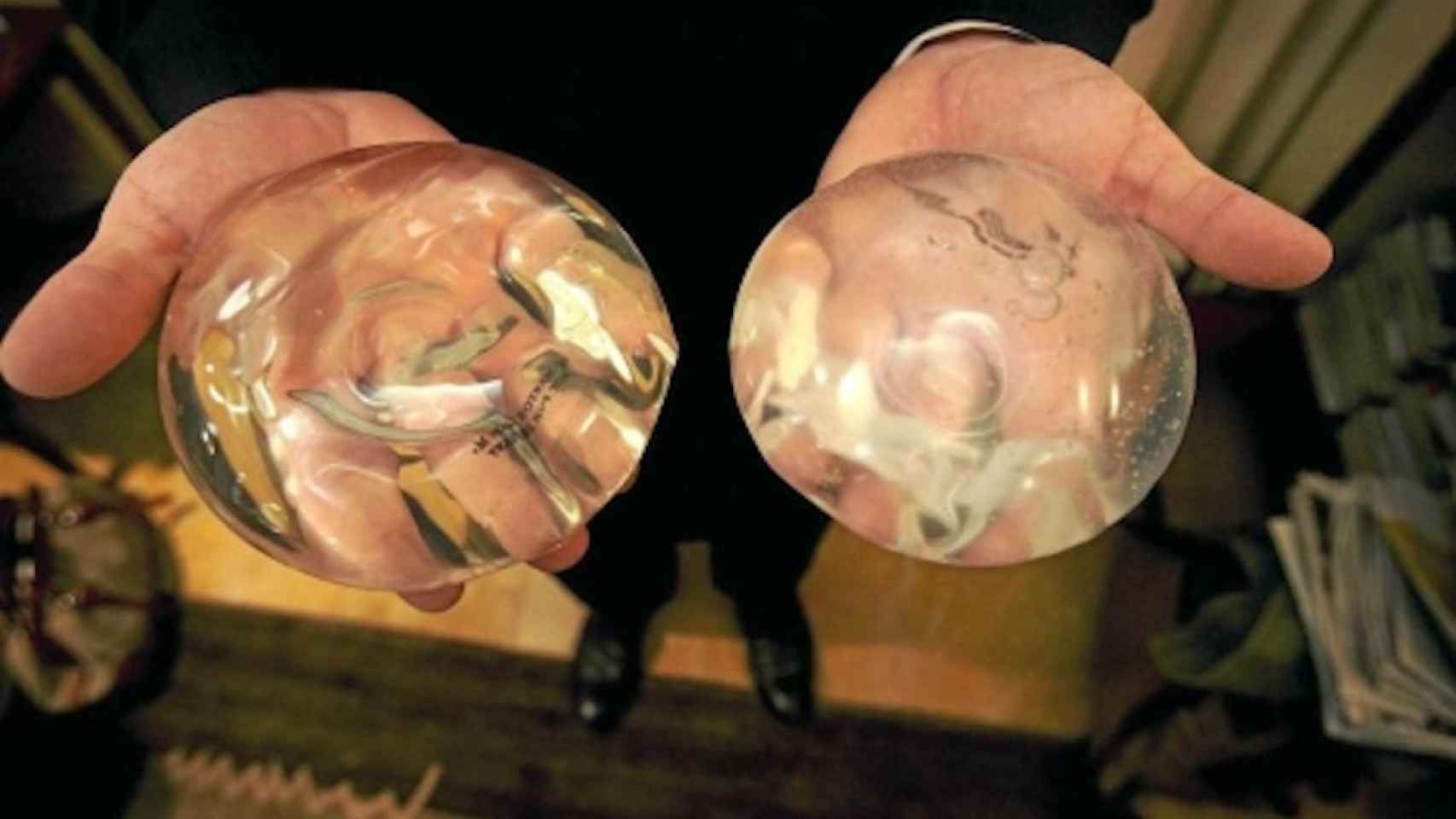 Una foto de archivo de dos implantes mamarios