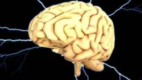 Imagen del cerebro humano con descargas eléctricas que brotan de él / PIXABAY