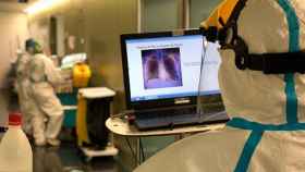 Un médico usa la inteligencia artificial para detectar el Covid-19 / HOSPITAL DEL MAR