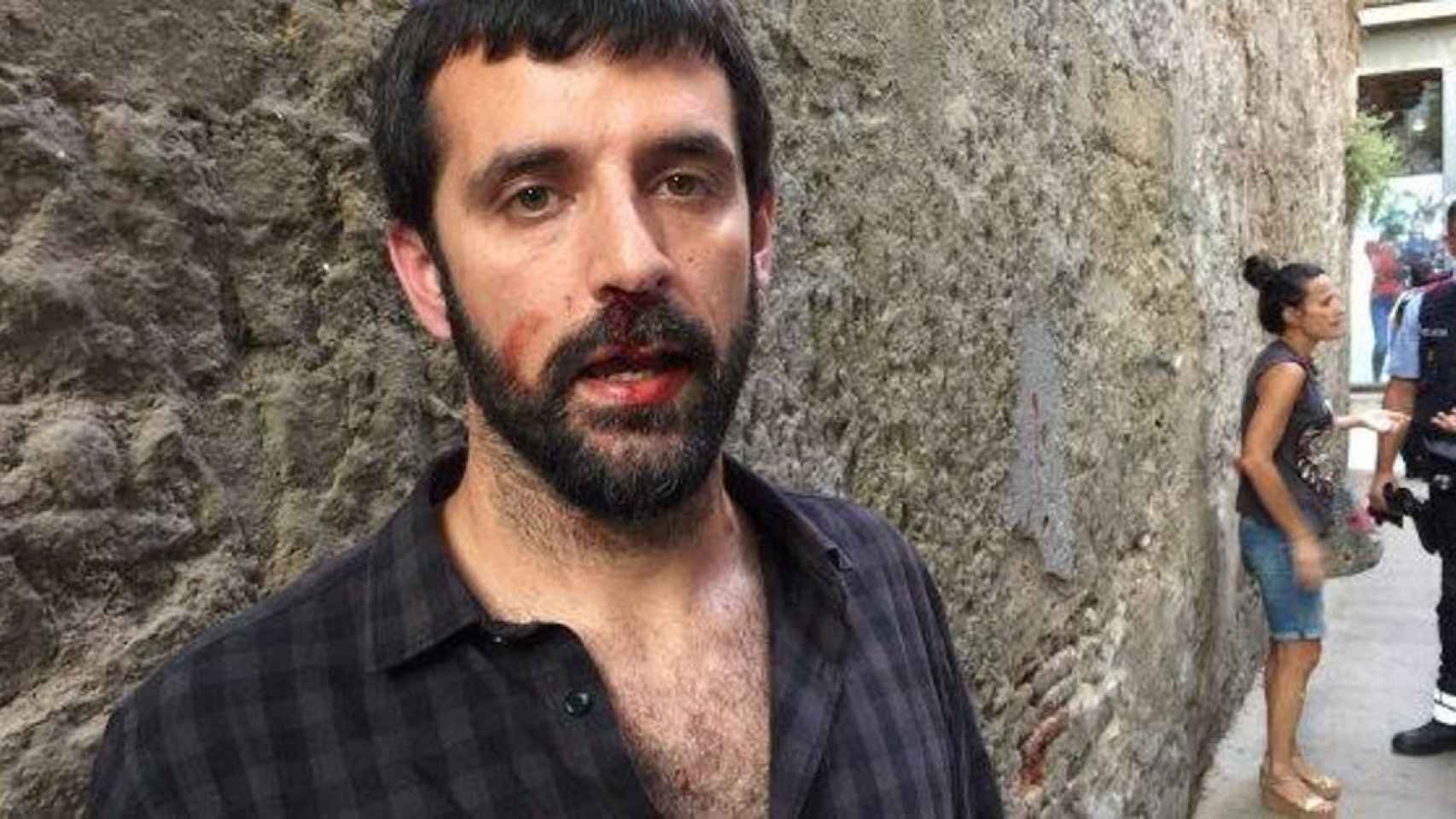 El fotógrafo de 'El Món' Jordi Borràs tras la agresión del policía / TWITTER