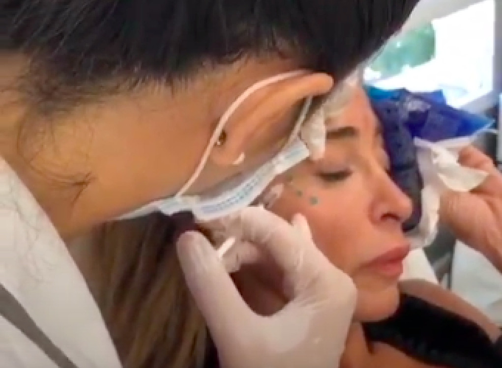 Una doctora inyecta en la cara de María Patiño bótox y vitaminas / INSTAGRAM