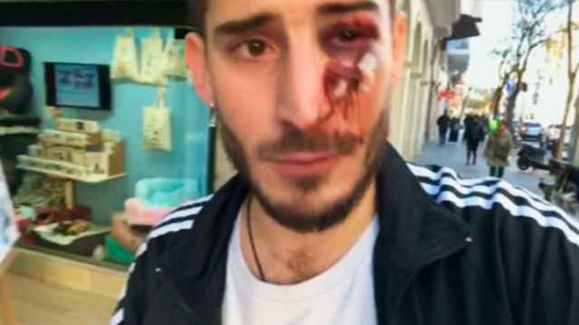 Imagen de la víctima de la última agresión, en este caso homófoba, en el Metro de Barcelona / CG