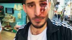 Imagen de la víctima de la última agresión, en este caso homófoba, en el Metro de Barcelona / CG