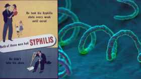 Cartel sobre sífilis y la bacteria de la enfermedad.