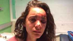 La estudiante estadounidense ha compartido en Facebook su imagen tras ser agredida