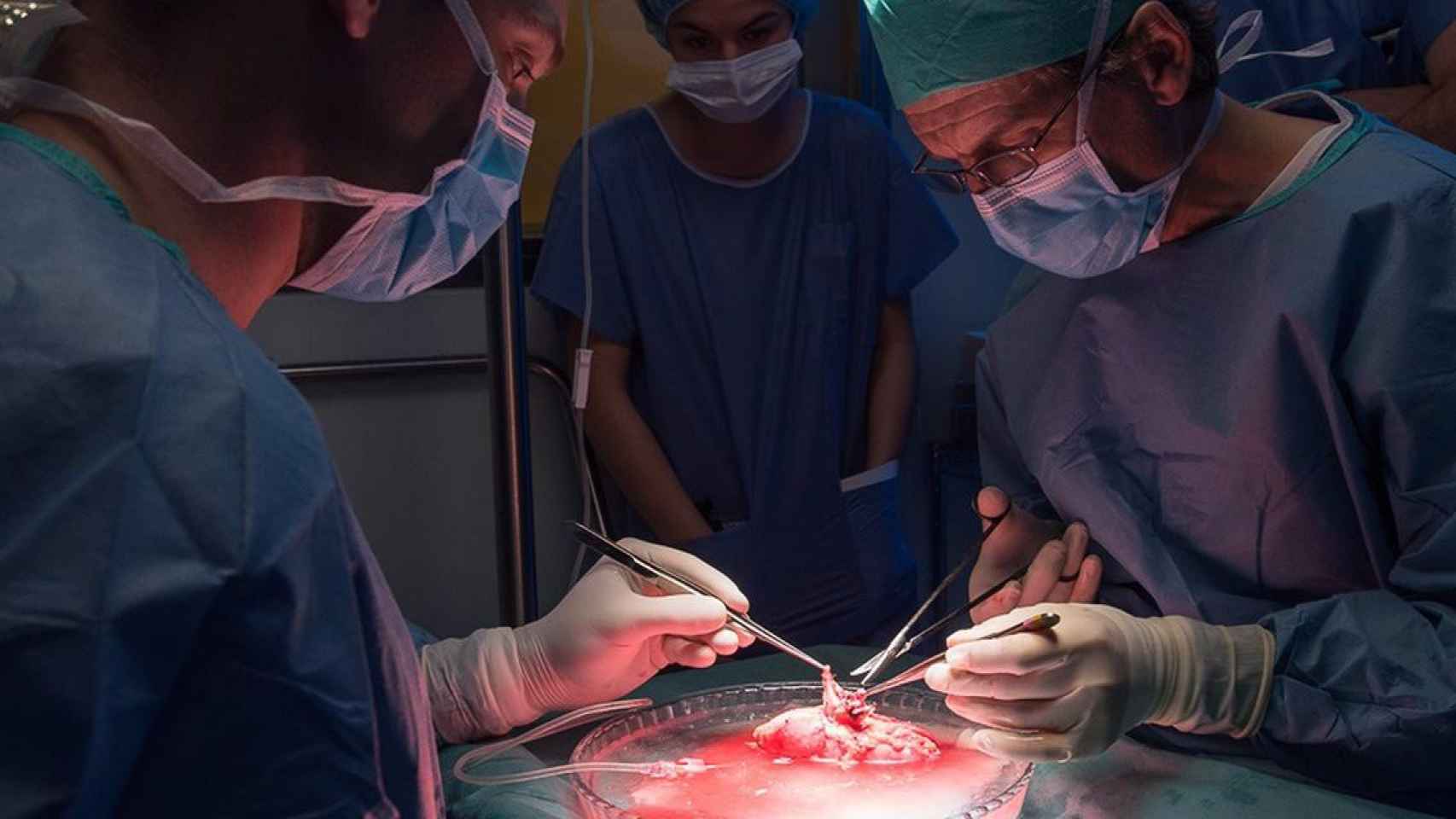 Personal sanitario realiza un trasplante renal robótico en el Hospital Clínic de Barcelona / HOSPITAL CLINIC