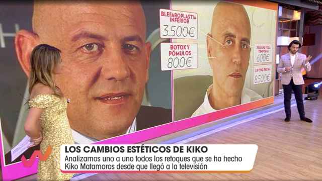 El impactante cambio físico de Kiko Matamoros después de gastarse más de 40.000 euros