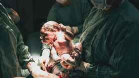 Imagen de un bebé recién nacido en un quirófano / Pexels - Natalia Olivera