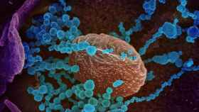 Imagen microscópica del coronavirus (en azul) / EFE