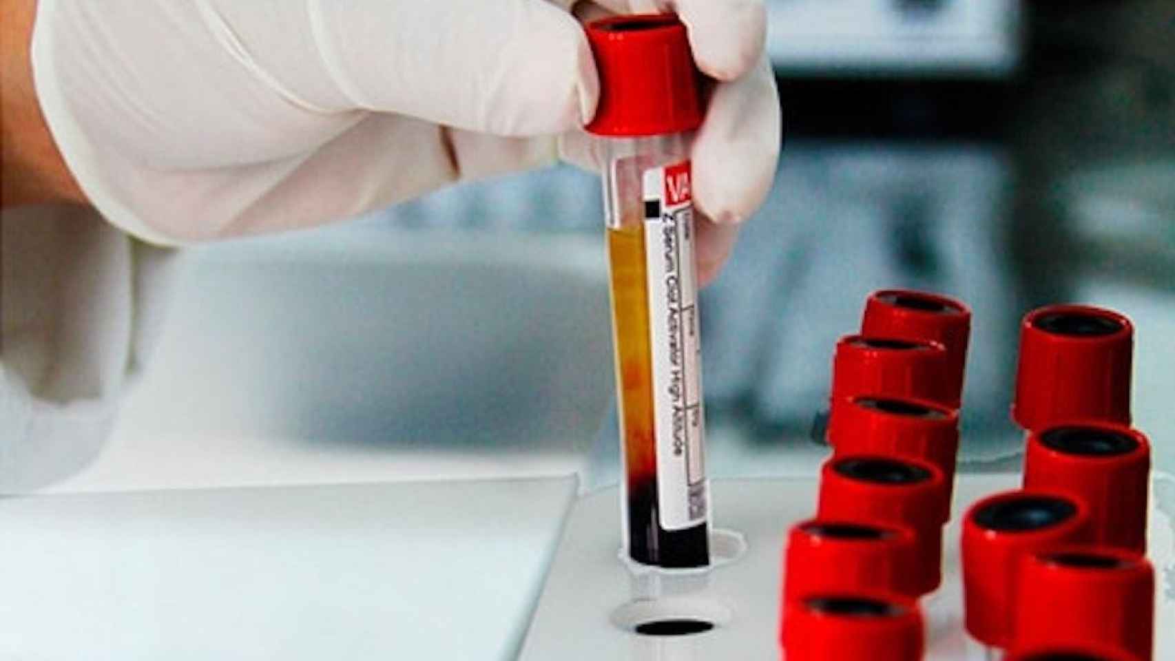 Una foto de archivo de pruebas de sangre en un laboratorio