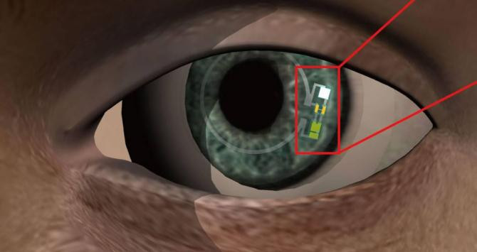 Sensores de la lentilla inteligente / UNIST