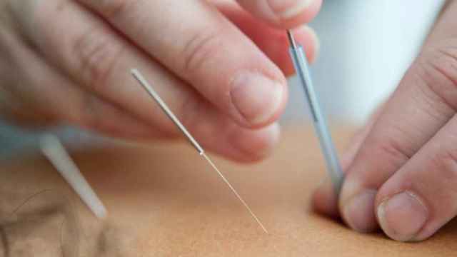 Colocando las agujas de una sesión de acupuntura / Katherine Hanlon en UNSPLASH