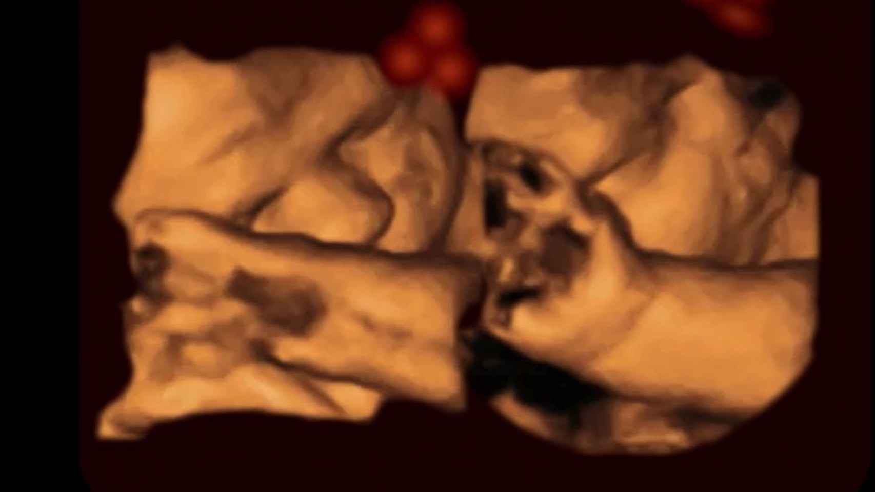 Los fetos reaccionan igual que los bebés al ver caras humanas