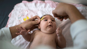 El bebé de una mujer de Barcelona es el primero en España en contraer microcefalia por el virus del zika.
