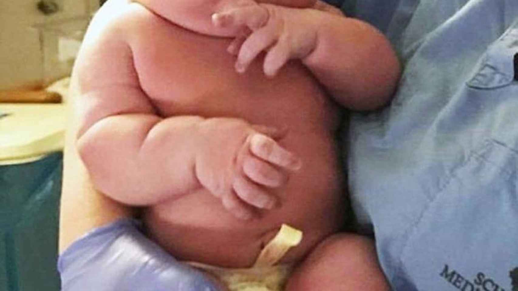 El bebé peso cuatro kilos más del peso estándar
