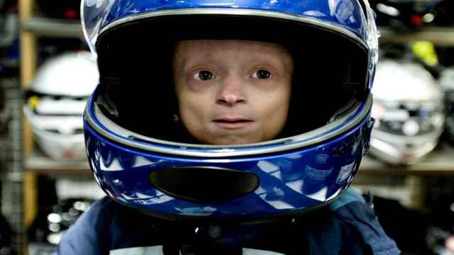 Niño con progeria / EFE