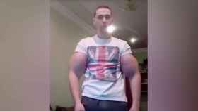 Una foto de archivo del joven ruso que se inyectaba aceite en los bíceps