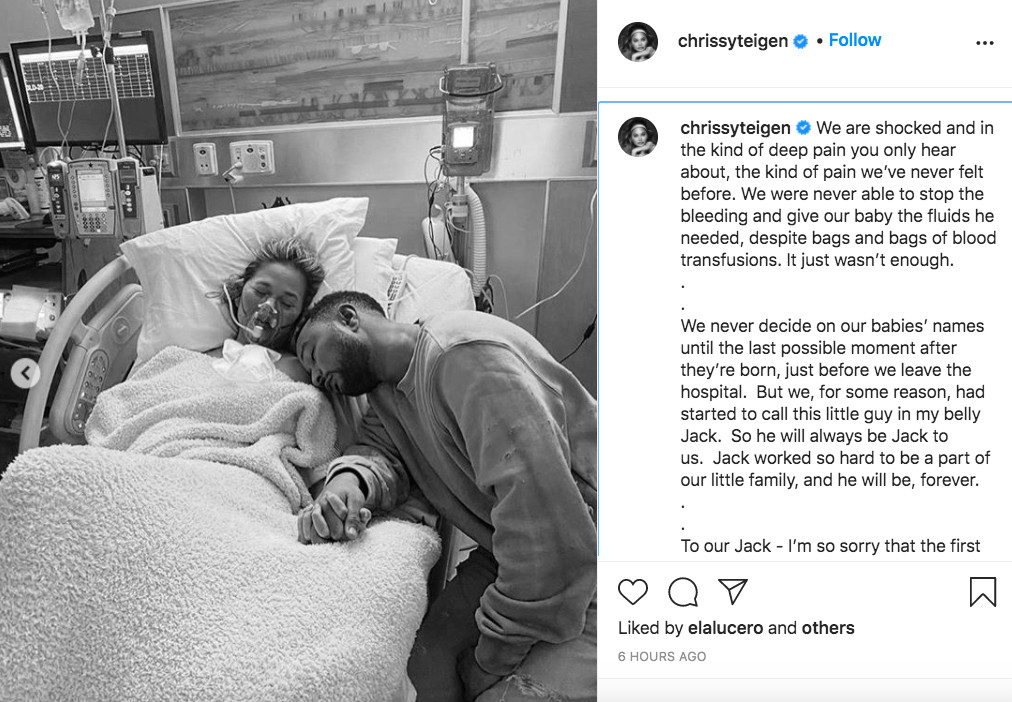 Chrissy Teigen anuncia la muerte del bebé que estaba esperando junto a John Legend / INSTAGRAM
