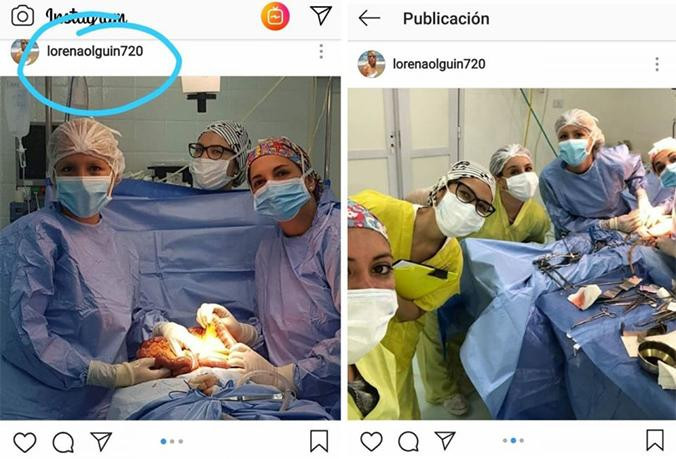 Estos son los selfis del equipo médico del Hospital San José durante la operación que han causado la polémica / INSTAGRAM