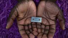 La mutilación genital femenina afecta a más de 200 millones de mujeres y niñas en todo el mundo / EP