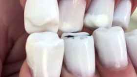 Una foto de archivo de las nuevas uñas con forma de dientes / Instagram