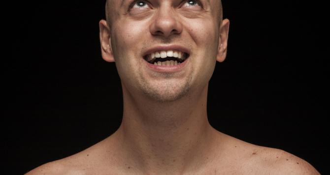 Hombre que sufre alopecia / CREATIVE COMMONS