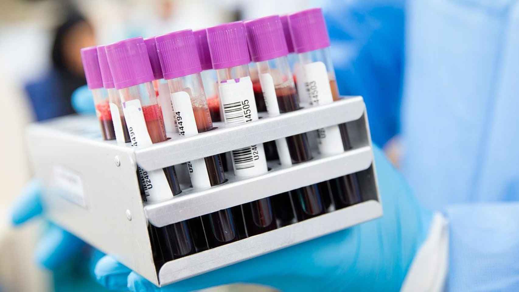 Muestras de sangre en un laboratorio de España / PIXABAY