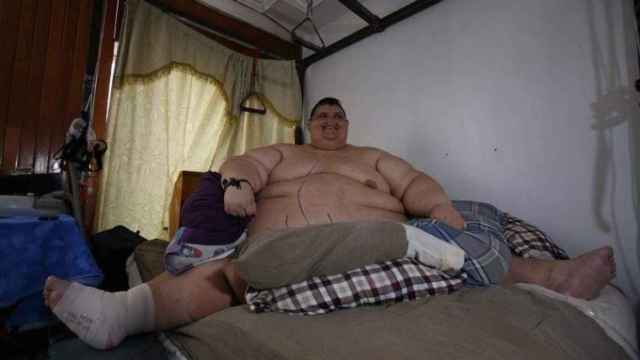 El hombre más gordo del mundo podrá ser operado tras adelgazar