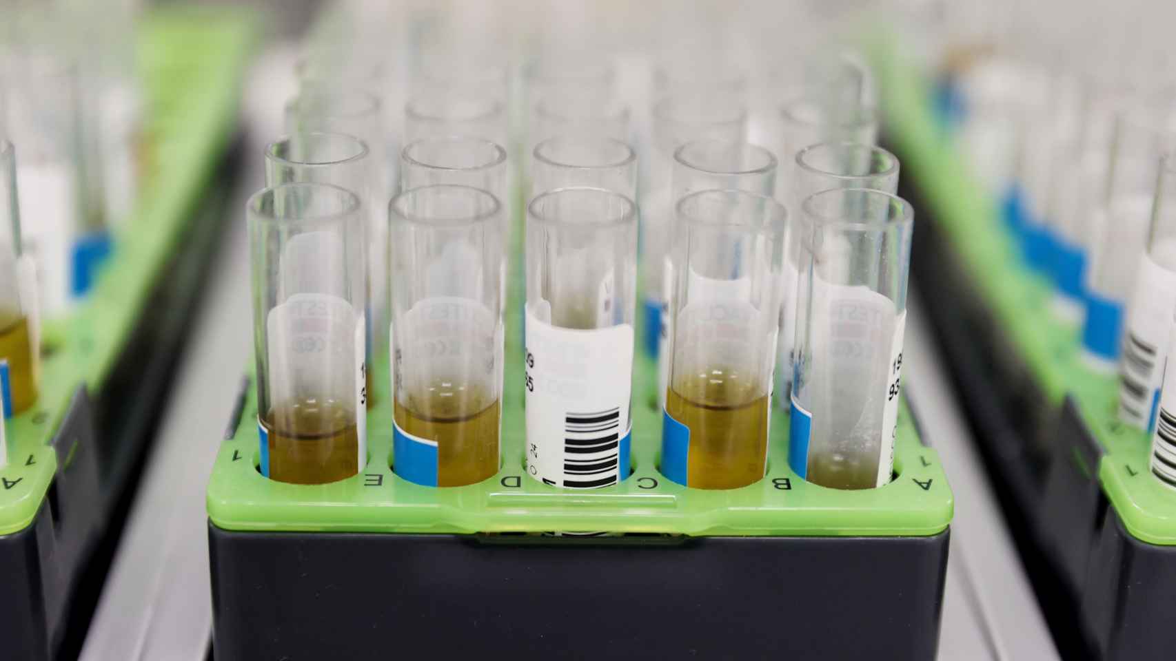 Probetas de pruebas PCR en el Laboratorio de Microbiología del Hospital público Gregorio Marañón, en Madrid, donde también hay casos de viruela del mono / Eduardo Parra - EUROPA PRESS