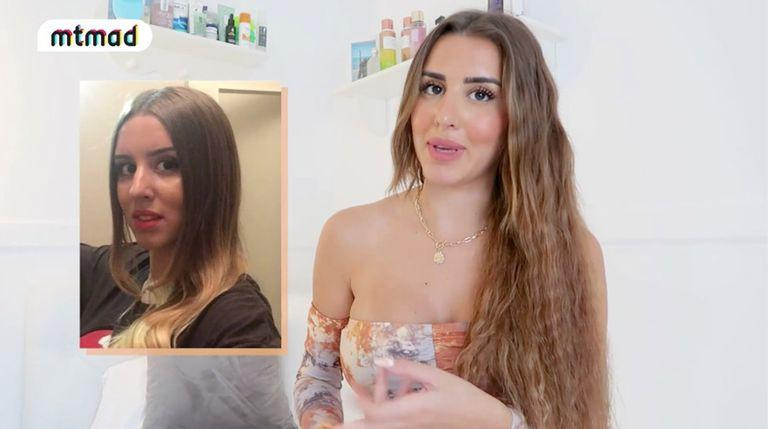 Antes y después de la cara de Marina / MEDIASET