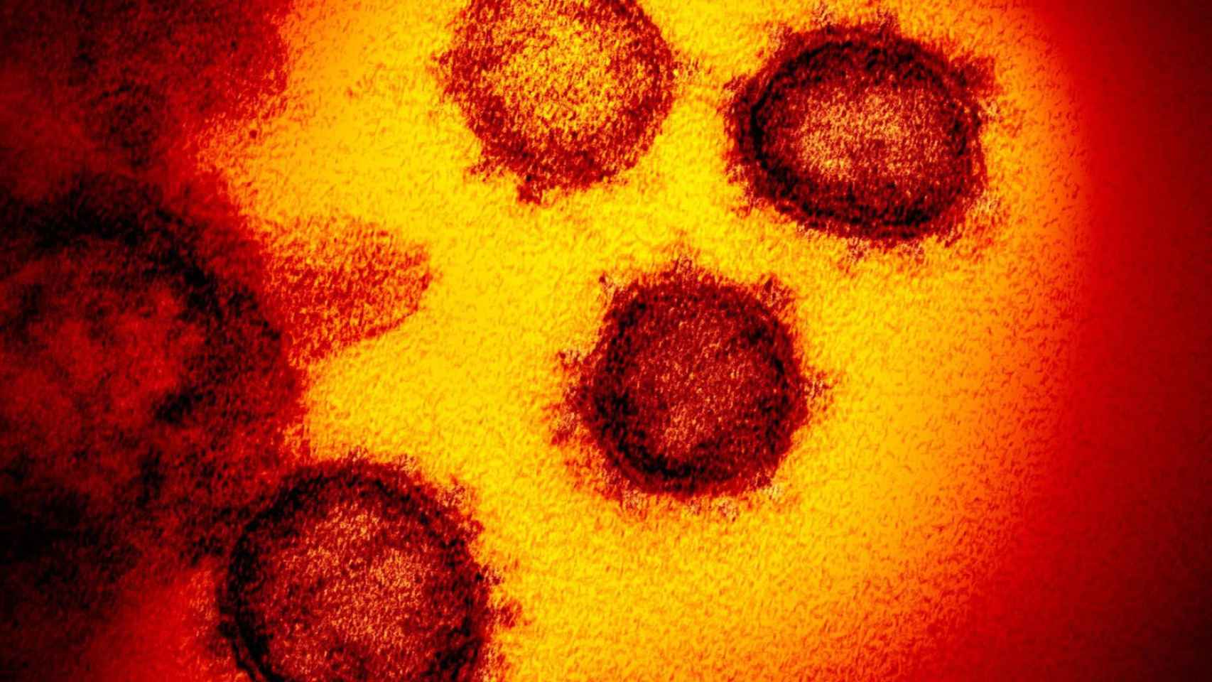 Imagen microcópica del coronavirus / EFE