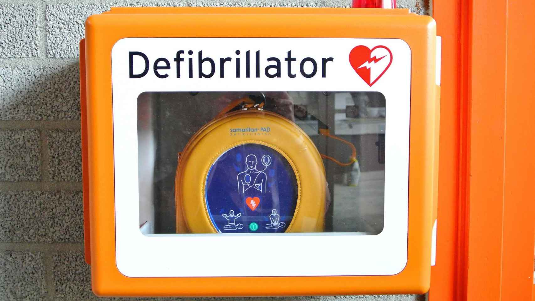 Desfibrilador es un aparato que se utiliza en caso de infarto / PIXABAY