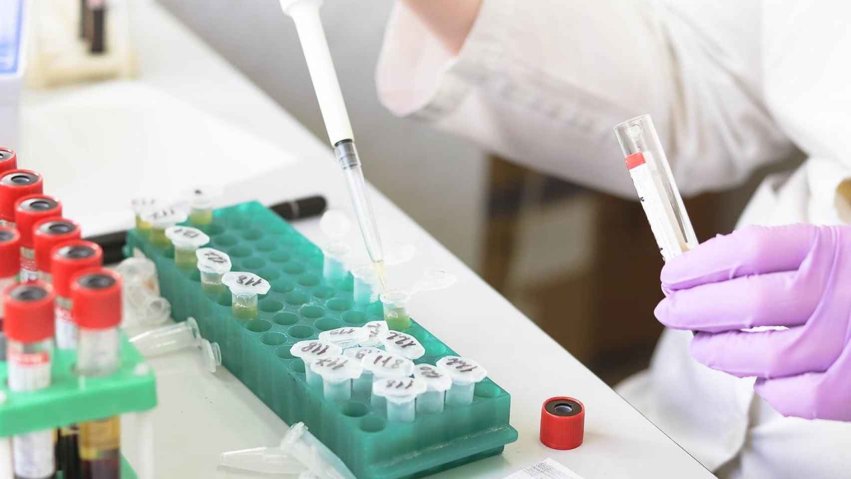 Tests de antígenos en un laboratorio / PIXABAY