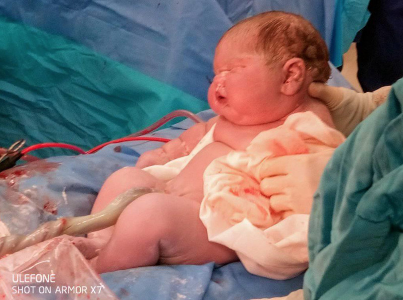 El bebé de casi 7 kilos en el momento del parto / Facebook de la madre, Cherral