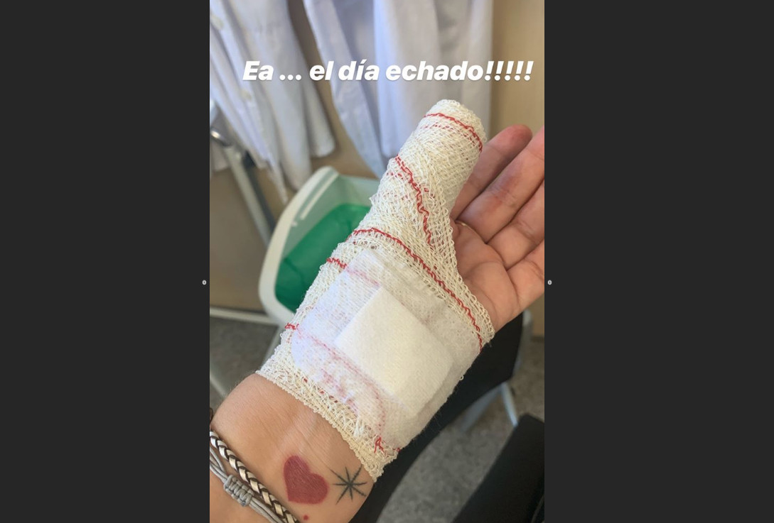 Toñi Moreno publica una foto de su mano izquierda después de las curas / INSTAGRAM